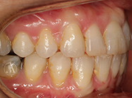 After - Ali Orthodontics Dental
