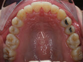 After - Ali Orthodontics Dental