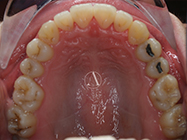 After - Ali Orthodontics Dental