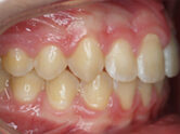 After - Ali Orthodontics Dental