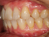 After - Ali Orthodontics Dental