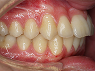 After - Ali Orthodontics Dental