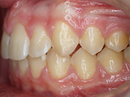 After - Ali Orthodontics Dental
