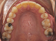 After - Ali Orthodontics Dental