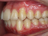 After - Ali Orthodontics Dental