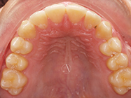 After - Ali Orthodontics Dental