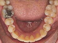 After - Ali Orthodontics Dental