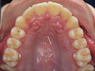 After - Ali Orthodontics Dental