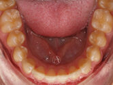 After - Ali Orthodontics Dental