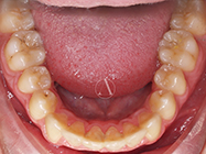 After - Ali Orthodontics Dental