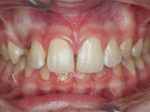 Before - Ali Orthodontics Dental
