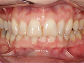 Before - Ali Orthodontics Dental