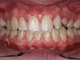Before - Ali Orthodontics Dental