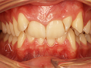 Before - Ali Orthodontics Dental