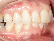 Before - Ali Orthodontics Dental