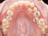 Before - Ali Orthodontics Dental
