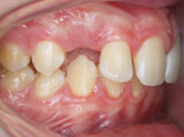 Before - Ali Orthodontics Dental