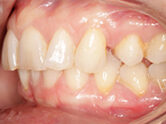 Before - Ali Orthodontics Dental