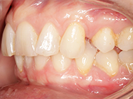 Before - Ali Orthodontics Dental