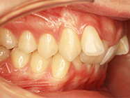 Before - Ali Orthodontics Dental