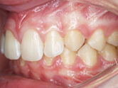 Before - Ali Orthodontics Dental