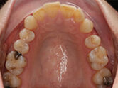 Before - Ali Orthodontics Dental