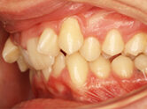 Before - Ali Orthodontics Dental