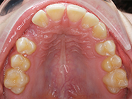 Before - Ali Orthodontics Dental