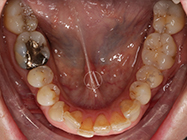Before - Ali Orthodontics Dental