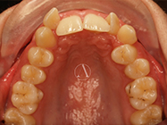 Before - Ali Orthodontics Dental