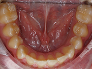 Before - Ali Orthodontics Dental