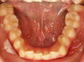 Before - Ali Orthodontics Dental