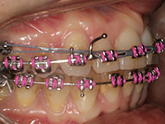 After - Ali Orthodontics Dental