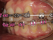After - Ali Orthodontics Dental