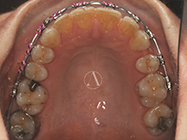 After - Ali Orthodontics Dental