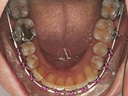 After - Ali Orthodontics Dental