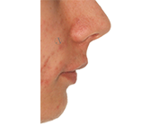 Before - Ali Orthodontics Dental