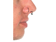 After - Ali Orthodontics Dental