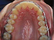 After - Ali Orthodontics Dental