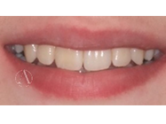 After - Ali Orthodontics Dental