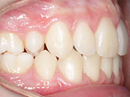 After - Ali Orthodontics Dental
