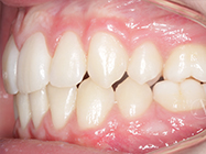 After - Ali Orthodontics Dental