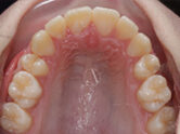 After - Ali Orthodontics Dental
