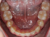 After - Ali Orthodontics Dental