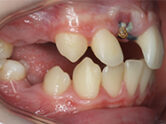 Before - Ali Orthodontics Dental