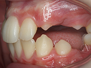 Before - Ali Orthodontics Dental