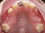 Before - Ali Orthodontics Dental