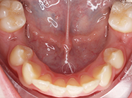 Before - Ali Orthodontics Dental