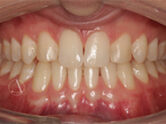 After - Ali Orthodontics Dental