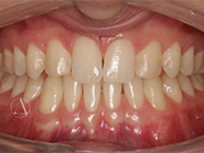 After - Ali Orthodontics Dental